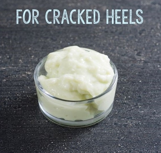 Cracked Feet and Heal Balm
